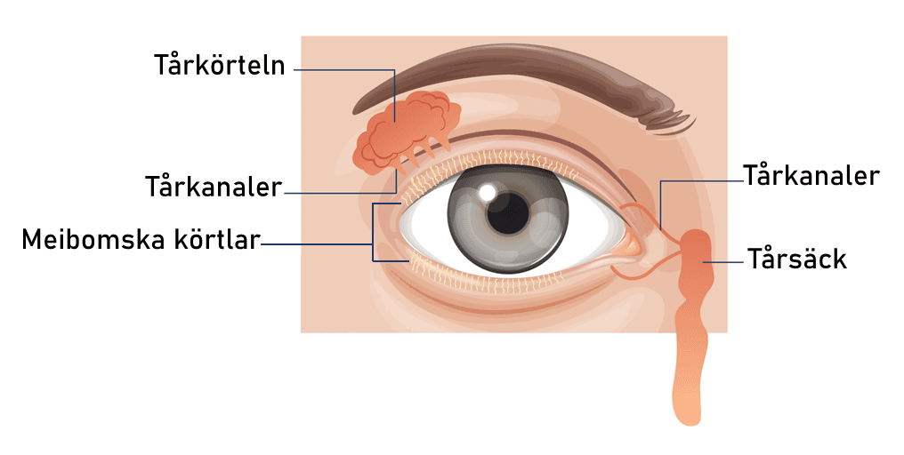Illustration av meibomsk körteldysfunktion