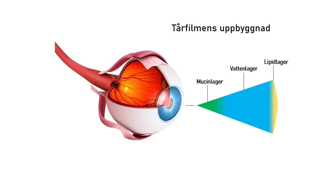 Illustration av torra ögon och ögonhälsa